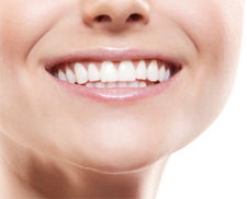 dental implant reviews San Francisco