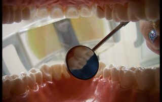 Look for the best dental implants, not the cheapest.